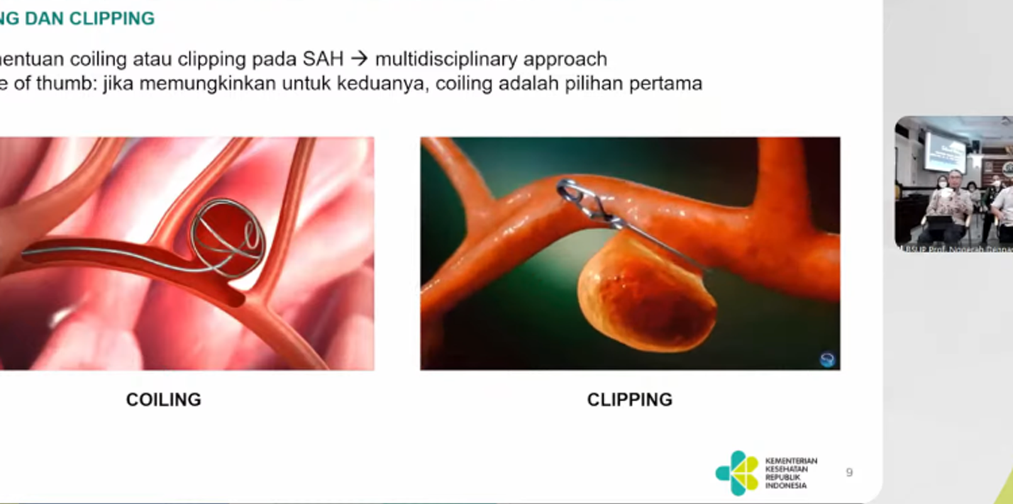 RSUP Prof. dr. I Gusti Ngoerah Bali Menerapkan Teknologi Terbaru Dalam Penanganan Stroke RSUP Prof. dr. I Gusti Ngoerah Bali Menerapkan Teknologi Terbaru Dalam Penanganan Stroke
